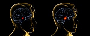 neuroimaging1